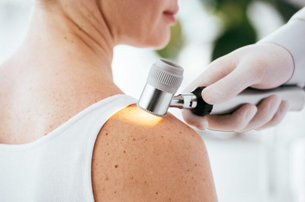 Visita dermatologica con dermatoscopio per il controllo dei nei e la diagnosi precoce del melanoma