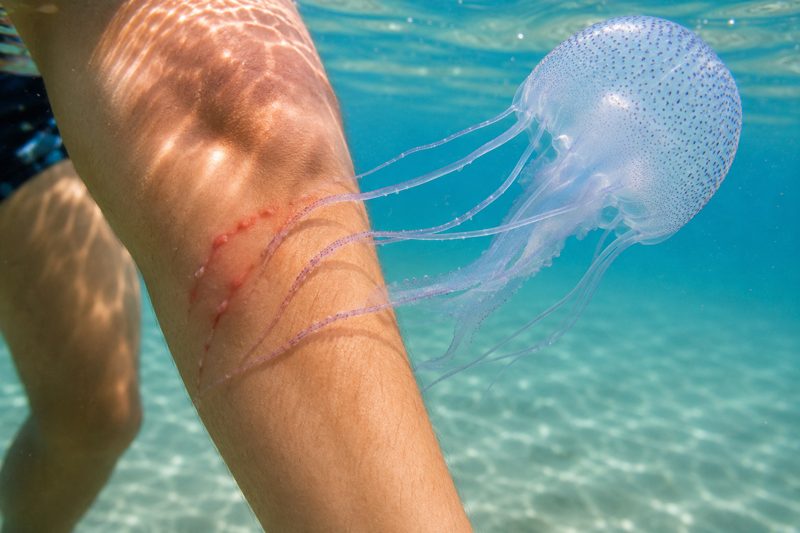 Tentacoli di medusa vicino alla pelle durante un contatto accidentale in mare.