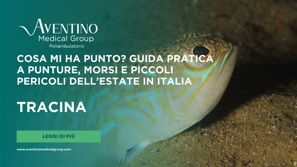 Puntura di tracina o pesce ragno: cosa fare subito, sintomi e rimedi contro il dolore