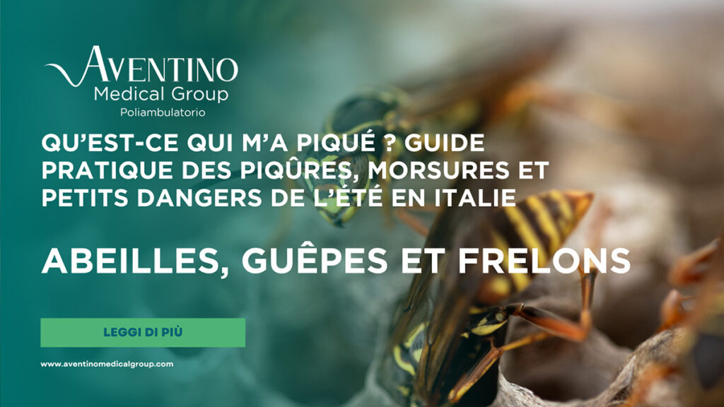Piqûre de guêpe, d’abeille ou de frelon : que faire immédiatement, symptômes d’allergie et quand aller aux urgence