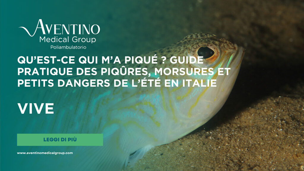 Piqûre de vive ou poisson-araignée : que faire immédiatement, symptômes et moyens de soulager la douleur